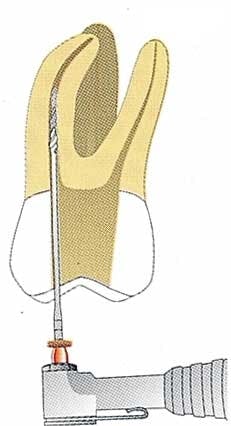 Th 0406dem527 Th 0406dem527