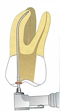 Th 0406dem528 Th 0406dem528