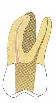 Th 0406dem529 Th 0406dem529