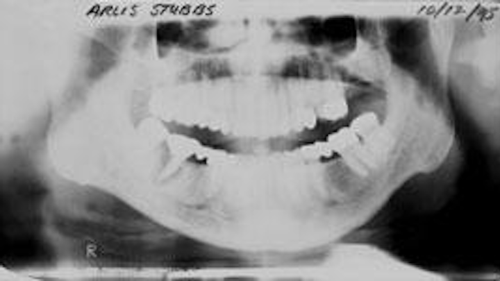 Th 0504wdjbone01