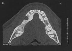 Th 0504wdjbone02 Th 0504wdjbone02