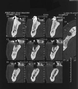 Th 0504wdjbone02a Th 0504wdjbone02a