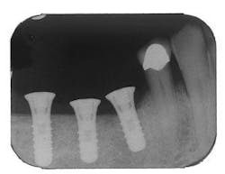 Th 0504wdjbone05 Th 0504wdjbone05