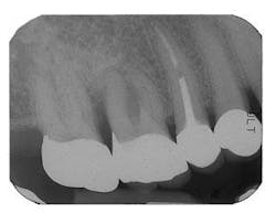 Th 0504wdjbone06 Th 0504wdjbone06