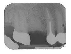 Th 0504wdjbone07 Th 0504wdjbone07