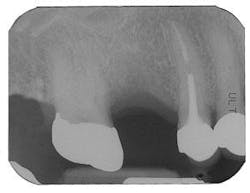 Th 0504wdjbone08 Th 0504wdjbone08