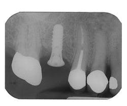 Th 0504wdjbone10 Th 0504wdjbone10