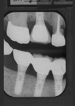 Th 0504wdjbone11 Th 0504wdjbone11