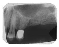 Th 0504wdjbone12 Th 0504wdjbone12