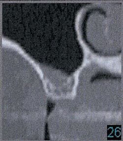 Th 0504wdjbone13 Th 0504wdjbone13