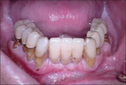 Th 0504wdjimpl01 Th 0504wdjimpl01