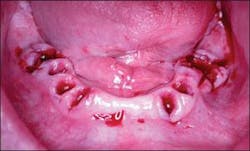 Th 0504wdjimpl03 Th 0504wdjimpl03