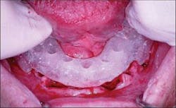 Th 0504wdjimpl05 Th 0504wdjimpl05