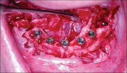 Th 0504wdjimpl06 Th 0504wdjimpl06