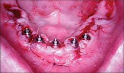 Th 0504wdjimpl07 Th 0504wdjimpl07