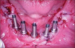 Th 0504wdjimpl10 Th 0504wdjimpl10