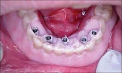 Th 0504wdjimpl11 Th 0504wdjimpl11