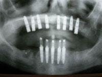 Th 0504wdjimpl15 Th 0504wdjimpl15