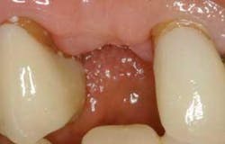 Th 0506dem Immed01 Th 0506dem Immed01