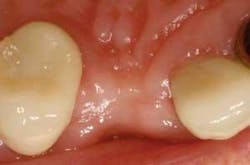 Th 0506dem Immed02 Th 0506dem Immed02