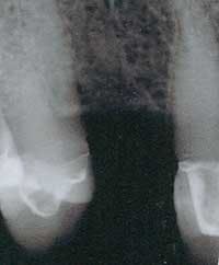 Th 0506dem Immed03 Th 0506dem Immed03