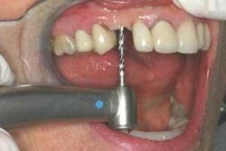 Th 0506dem Immed04 Th 0506dem Immed04