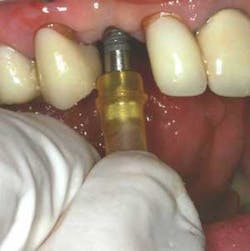 Th 0506dem Immed05 Th 0506dem Immed05