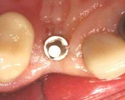 Th 0506dem Immed06 Th 0506dem Immed06