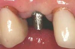 Th 0506dem Immed07 Th 0506dem Immed07