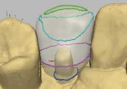 Th 0506dem Immed10 Th 0506dem Immed10