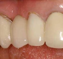 Th 0506dem Immed18 Th 0506dem Immed18