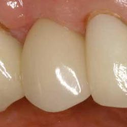 Th 0506dem Immed21 Th 0506dem Immed21