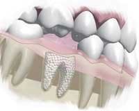 Th 0506dem Materials14 Th 0506dem Materials14