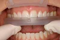 Th 0506dem Simple04 Th 0506dem Simple04