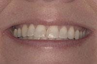 Th 0507wdjivo01 Th 0507wdjivo01