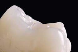 Th 0509dem Allveneers01 Th 0509dem Allveneers01