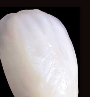 Th 0509dem Allveneers02