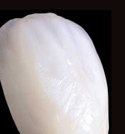 Th 0509dem Allveneers02 Th 0509dem Allveneers02