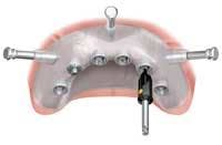 Th 0509dem Focusprod02 Th 0509dem Focusprod02