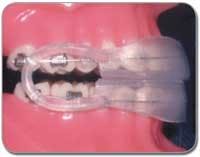 Th 0509dem Materprod11 Th 0509dem Materprod11