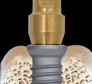 Th 0509dem Theevolution01