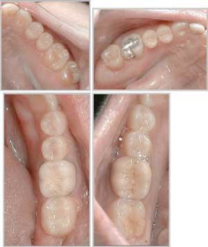 Th 0509dem Toolstorelieve01