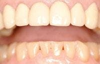 Th 0510wdjeat03 Th 0510wdjeat03