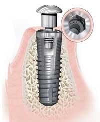 Th 0511dem Product06 Th 0511dem Product06