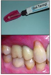 Th 0601wdjcoltenetemp Th 0601wdjcoltenetemp