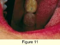 Th 0603dem033k Th 0603dem033k