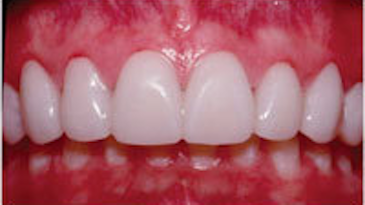 Th 0603wdjbra1
