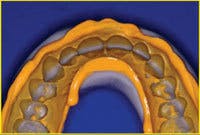 Th 0603wdjbra11 Th 0603wdjbra11