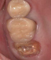 Th 0603wdjbra2 Th 0603wdjbra2