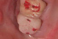 Th 0603wdjbra3 Th 0603wdjbra3